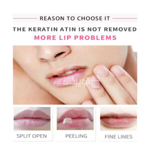 مرطب شفاه طبي استيلين